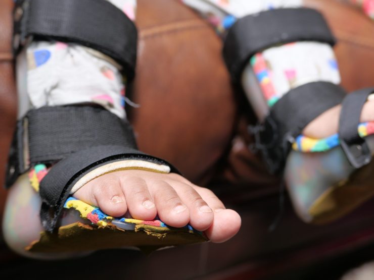 Child's feet in colorful orthopedic braces on a brown surface.