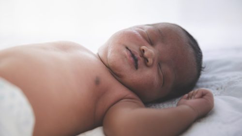 Peaceful sleeping infant, highlighting innocence and vulnerability in medical malpractice cases.