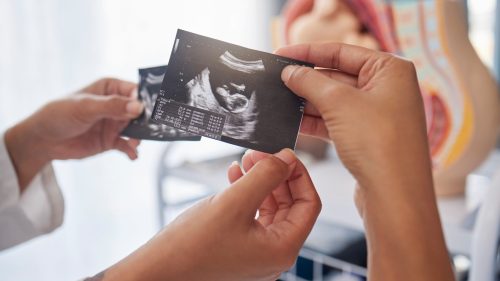 Doctor reviewing ultrasound images, focusing on fetal health, in a clinical setting.