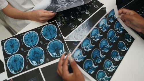 Professionals analyzing brain scans in a medical office setting.