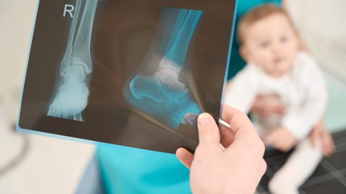 Medical professional examines infant foot X-ray, highlighting concern and professional assessment.