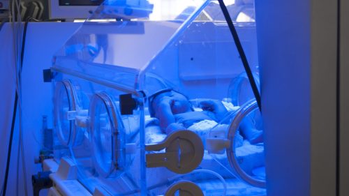 Infant receiving light therapy in hospital incubator, highlighting medical care vulnerability.