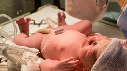 Newborn infant resting in a hospital, monitored by medical staff.