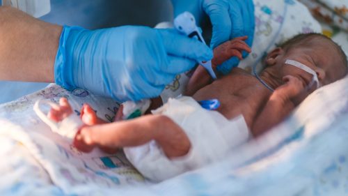 Premature infant receiving medical care in hospital incubator, monitored by gloved healthcare professional.