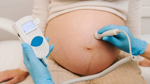Healthcare professional using Doppler device during prenatal exam on pregnant patient.