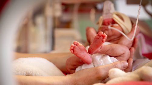 Tiny infant cradled in neonatal intensive care, highlighting vulnerability and care.