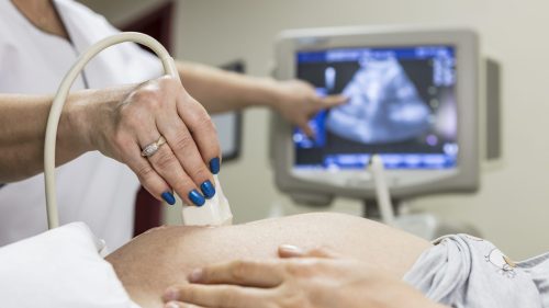Healthcare professional conducting a prenatal ultrasound with patient, displaying image on monitor.